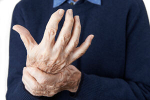 Senior home care can help seniors with Rheumatoid Arthritis manage their symptoms and get the support they need as they age in place.